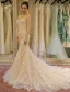 Glamourösen Brautkleider 2016 Abnehmbare Kragen & Ärmeln Nixe Spitze Hochzeitskleid