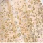 Sparkly Champagne Rhinestone Sequins Prom Dresses 2024 A-Line / Princess High Neck Sleeveless Backless Floor-Length / Long Prom Formal Dresses